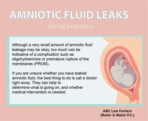 leaking amniotic fluid look like|Amniotic Fluid: What is It and Signs of Leaking